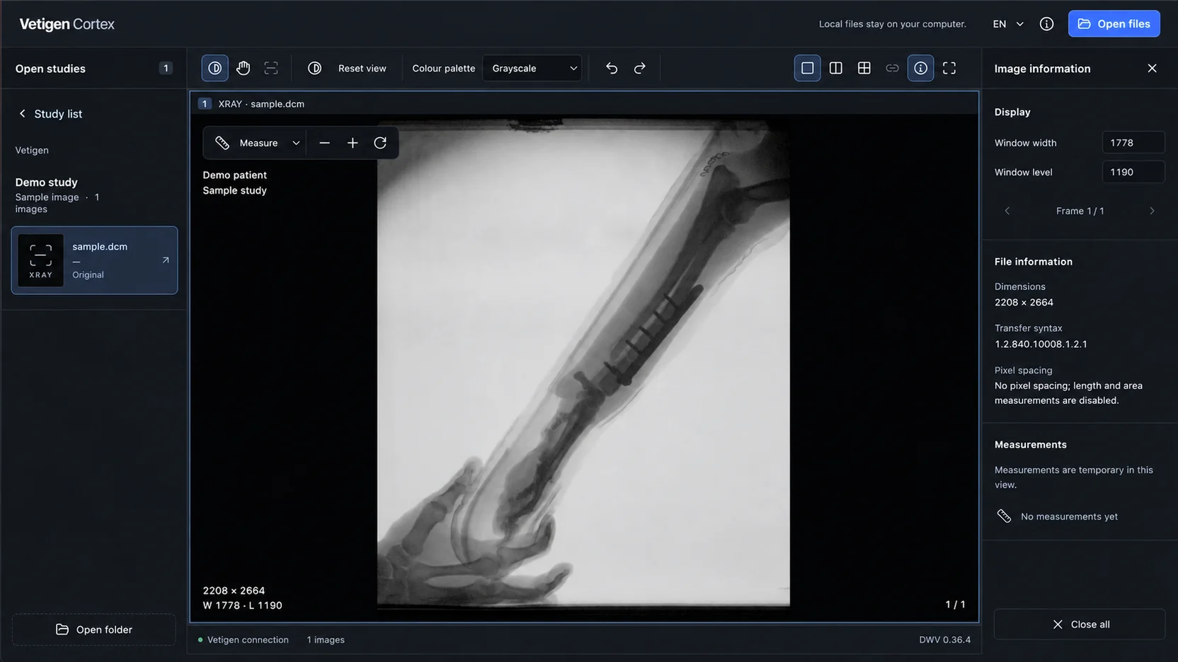 Vista amplia de Cortex con una radiografía de ejemplo y herramientas de imagen.